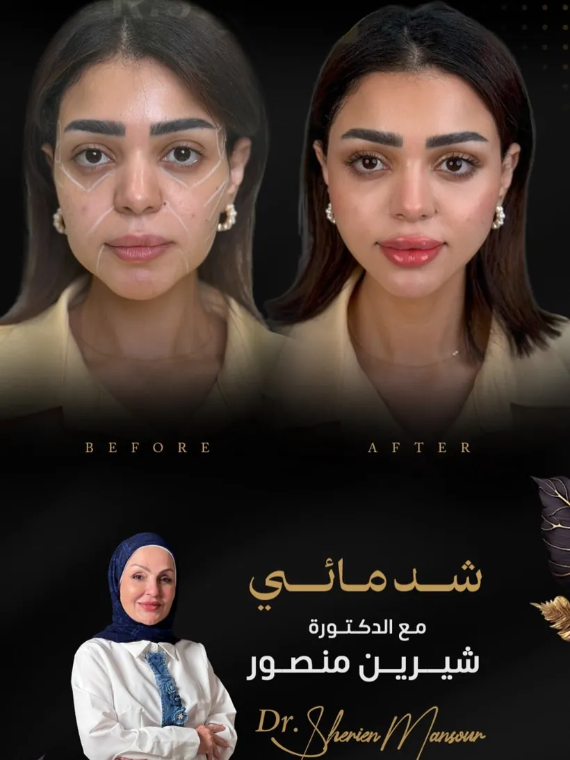 نتيجة